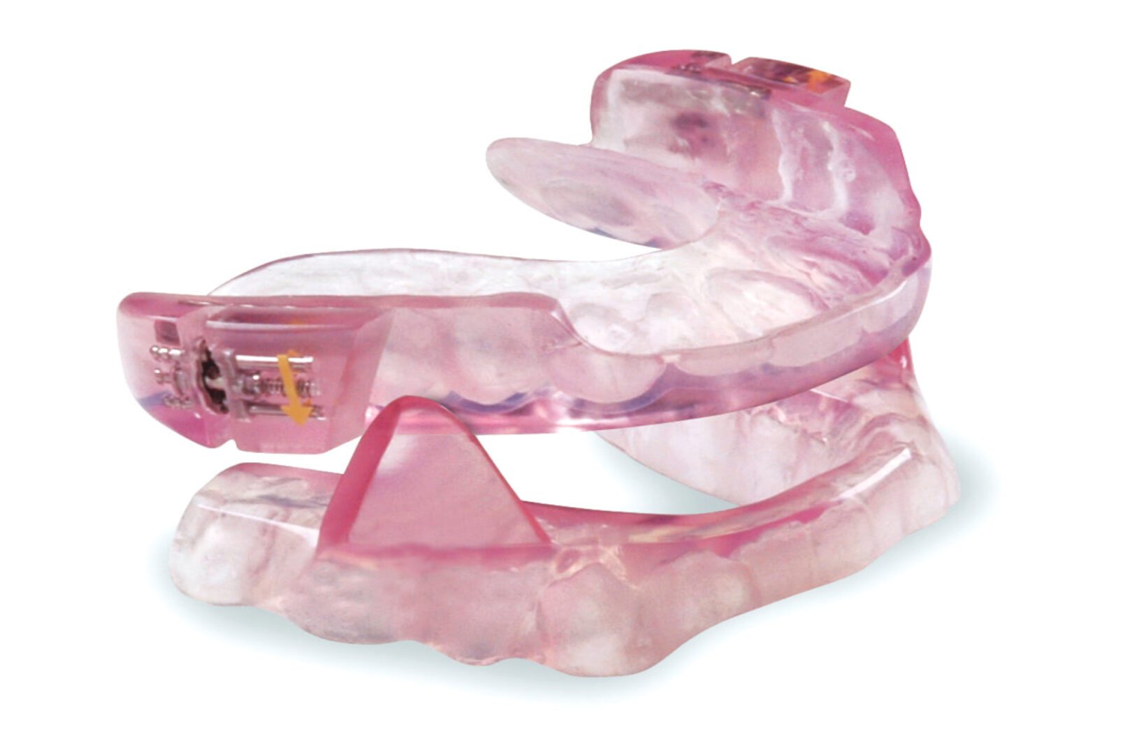 Oral Appliance